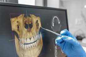 3D CT Scanning